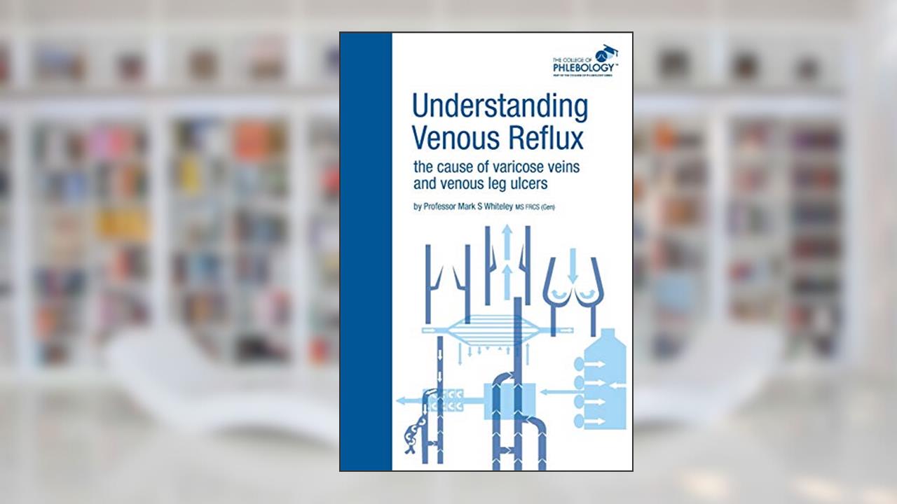 Understanding Venous Reflux the Cause of Varicose Veins and Venous Leg Ulcers: Varicose veins and venous leg ulcers (College of Phlebology), written by Mark S Whiteley