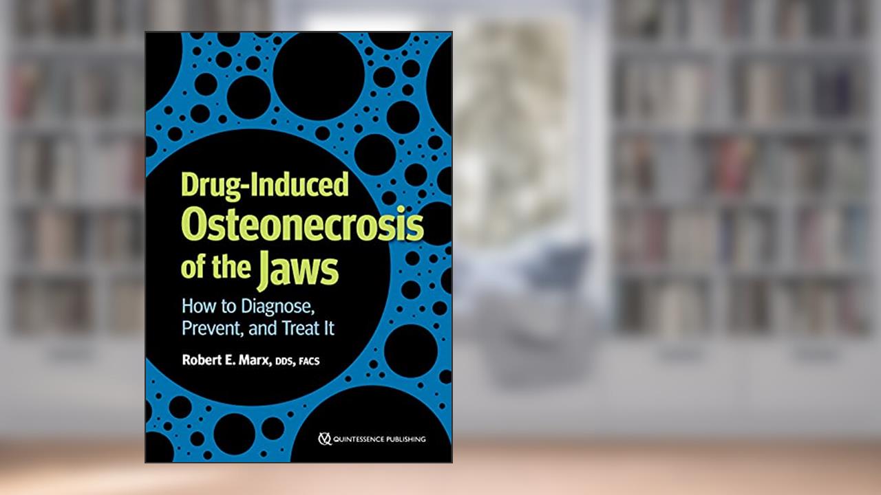 Drug-induced Osteonecrosis of the Jaws: How to Diagnose, Prevent, and Treat It, written by Robert E. Marx