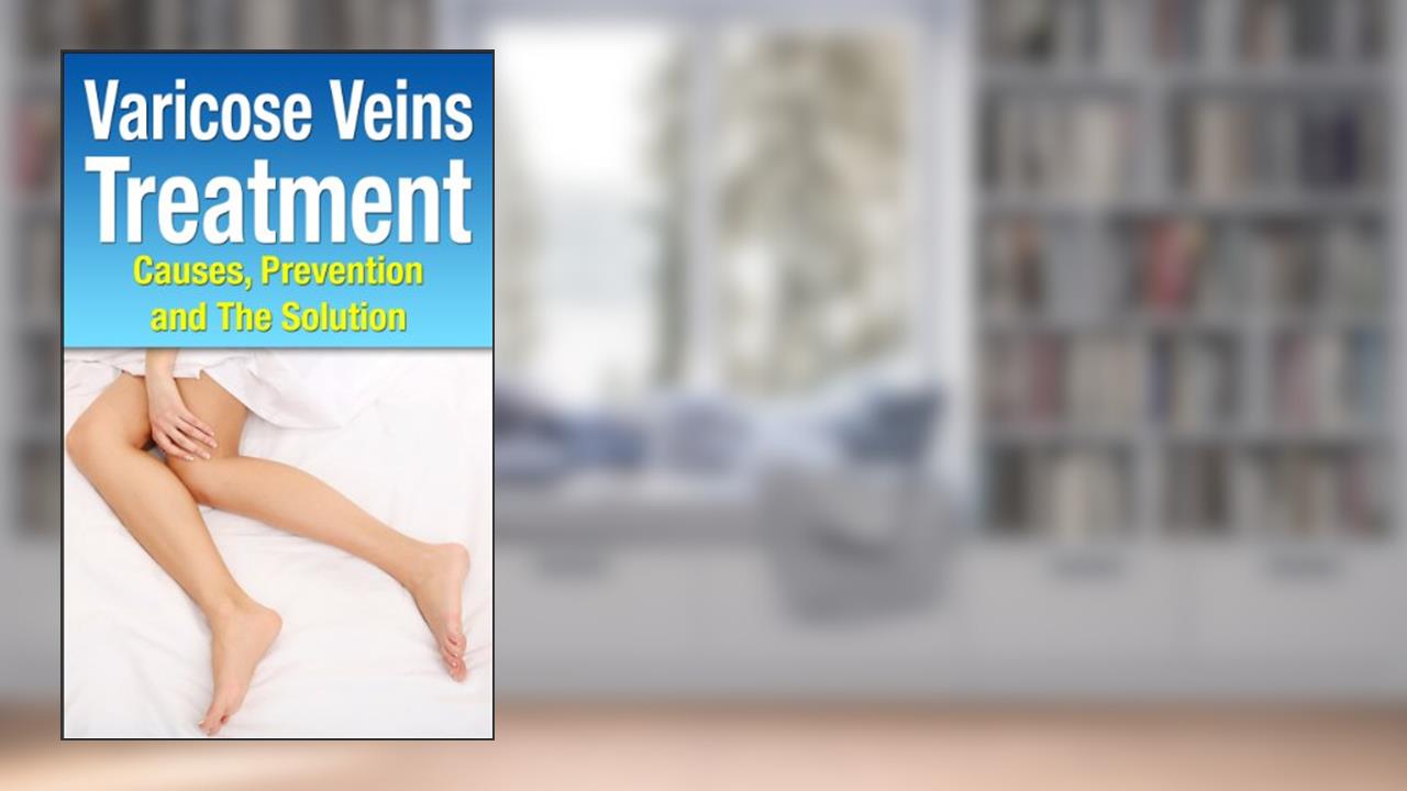Varicose Veins Treatment, written by William Gray