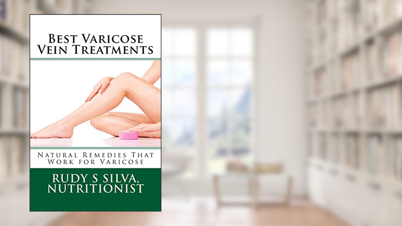 Best Varicose Vein Treatments: Natural Remedies That Work For Varicose, written by Rudy Silva Silva