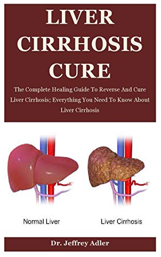 Read Liver Cirrhosis Cure: The Complete Healing Guide To Reverse And Cure Liver Cirrhosis; Everything You Need To Know About Liver Cirrhosis, written by Dr. Jeffrey Adler