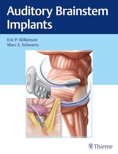 Read Auditory Brainstem Implants, written by Eric P. Wilkinson; Marc S. Schwartz