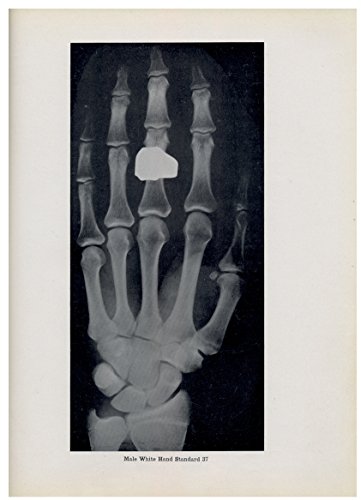 Read Atlas of Skeletal Maturation., written by T. Wingate Todd Read Atlas of Skeletal Maturation., written by T. Wingate Todd