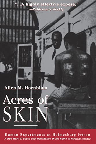 Read Acres of Skin: Human Experiments at Holmesburg Prison, written by Allen M. M. Hornblum Read Acres of Skin: Human Experiments at Holmesburg Prison, written by Allen M. M. Hornblum