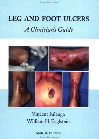 Read Leg and Foot Ulcers: A Clinician's Guide, written by William H Eaglstein; Vincent Falanga Read Leg and Foot Ulcers: A Clinician's Guide, written by William H Eaglstein; Vincent Falanga