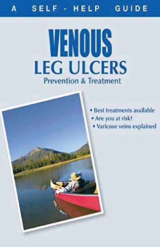 Read The Doctor's Guide to: Venous Leg Ulcers: Prevention and Treatment (Dr. Guide Books), written by Kenneth Wright Read The Doctor's Guide to: Venous Leg Ulcers: Prevention and Treatment (Dr. Guide Books), written by Kenneth Wright