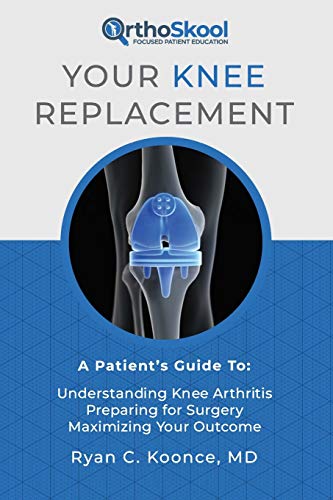 Read Your Knee Replacement: A Patient's Guide To: Understanding Knee Arthritis, Preparing for Surgery, Maximizing Your Outcome, written by Ryan C. Koonce MD Read Your Knee Replacement: A Patient's Guide To: Understanding Knee Arthritis, Preparing for Surgery, Maximizing Your Outcome, written by Ryan C. Koonce MD