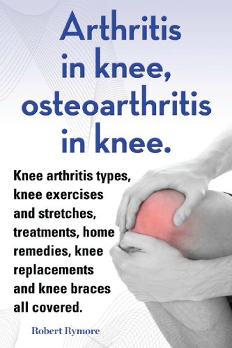 Read Arthritis in knee, osteoarthritis in knee. Knee arthritis exercises and stretches, treatments, home remedies, knee replacements and knee braces all covered., written by Robert Rymore Read Arthritis in knee, osteoarthritis in knee. Knee arthritis exercises and stretches, treatments, home remedies, knee replacements and knee braces all covered., written by Robert Rymore