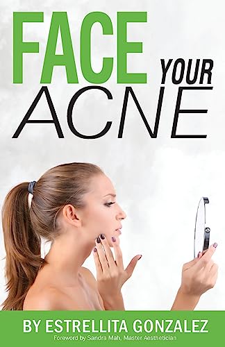 Read Face Your Acne, written by 7788 Estrellita Gonzalez Read Face Your Acne, written by 7788 Estrellita Gonzalez