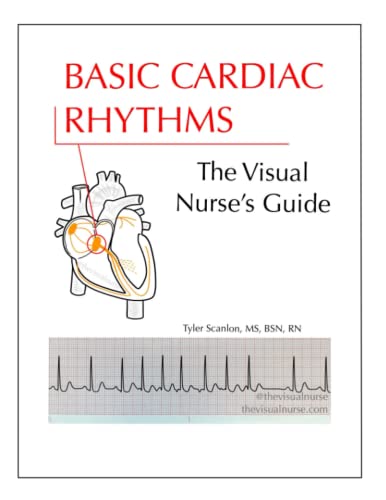 Read Basic Cardiac Rhythms: The Visual Nurse's Guide, written by Tyler Scanlon Read Basic Cardiac Rhythms: The Visual Nurse's Guide, written by Tyler Scanlon