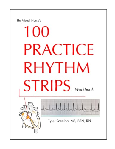 Read The Visual Nurse's 100 Practice Rhythm Strips Workbook, written by Tyler Scanlon Read The Visual Nurse's 100 Practice Rhythm Strips Workbook, written by Tyler Scanlon
