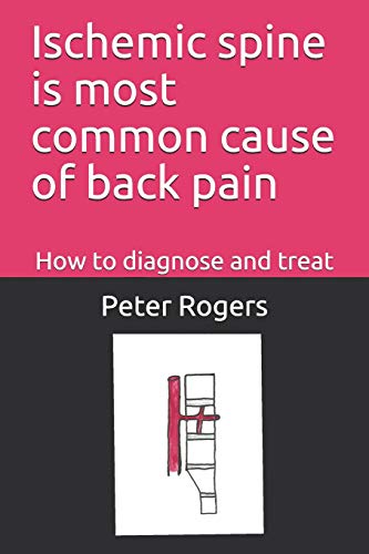 Read Ischemic spine is most common cause of back pain: How to diagnose and treat, written by Peter Rogers MD Read Ischemic spine is most common cause of back pain: How to diagnose and treat, written by Peter Rogers MD
