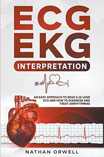 Read ECG/EKG Interpretation: An Easy Approach to Read a 12-Lead ECG and How to Diagnose and Treat Arrhythmias, written by Nathan Orwell Read ECG/EKG Interpretation: An Easy Approach to Read a 12-Lead ECG and How to Diagnose and Treat Arrhythmias, written by Nathan Orwell