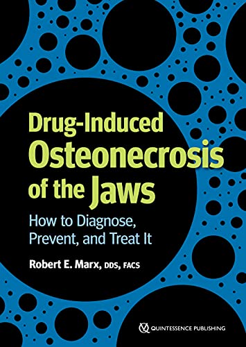 Read Drug-induced Osteonecrosis of the Jaws: How to Diagnose, Prevent, and Treat It, written by Robert E. Marx Read Drug-induced Osteonecrosis of the Jaws: How to Diagnose, Prevent, and Treat It, written by Robert E. Marx