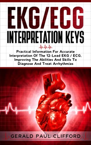Read EKG/ECG Interpretation Keys: Practical Information For Accurate Interpretation Of The 12-Lead EKG / ECG, Improving The Abilities And Skills To Diagnose And Treat Arrhythmias, written by Gearld Paul Clifford Read EKG/ECG Interpretation Keys: Practical Information For Accurate Interpretation Of The 12-Lead EKG / ECG, Improving The Abilities And Skills To Diagnose And Treat Arrhythmias, written by Gearld Paul Clifford