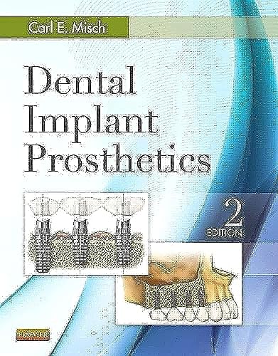 Read Dental Implant Prosthetics, written by Carl E. Misch DDS MDS PhD(HC) Read Dental Implant Prosthetics, written by Carl E. Misch DDS MDS PhD(HC)