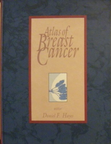 Read Atlas of Breast Cancer, written by Eberlein, Timothy J., M.D.; Abram Recht; Stuart Schnitt; Paul C. Stomper Read Atlas of Breast Cancer, written by Eberlein, Timothy J., M.D.; Abram Recht; Stuart Schnitt; Paul C. Stomper