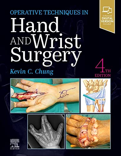 Read Operative Techniques: Hand and Wrist Surgery, written by Kevin C. Chung MD MS Read Operative Techniques: Hand and Wrist Surgery, written by Kevin C. Chung MD MS