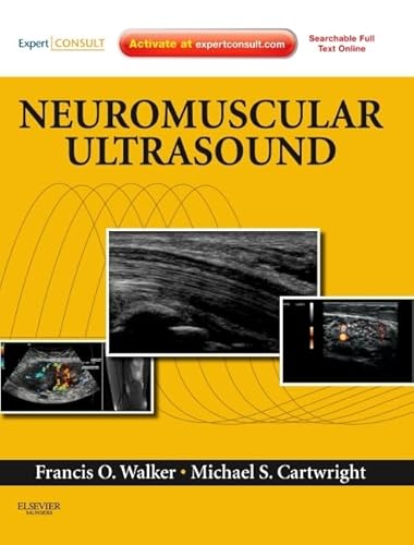 Read Neuromuscular Ultrasound: Expert Consult - Online and Print, written by Francis Walker MD; Michael S. Cartwright MD Read Neuromuscular Ultrasound: Expert Consult - Online and Print, written by Francis Walker MD; Michael S. Cartwright MD