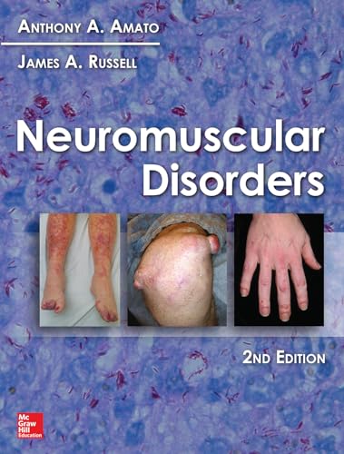 Read Neuromuscular Disorders, 2nd Edition, written by Anthony A. Amato; James A. Russell Read Neuromuscular Disorders, 2nd Edition, written by Anthony A. Amato; James A. Russell