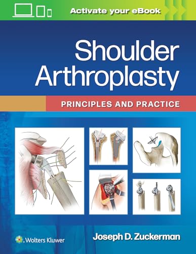 Read Shoulder Arthroplasty: Principles and Practice, written by Joseph D. Zuckerman MD Read Shoulder Arthroplasty: Principles and Practice, written by Joseph D. Zuckerman MD