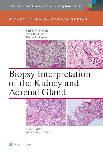Read Biopsy Interpretation of the Kidney & Adrenal Gland (Biopsy Interpretation Series), written by Satish Tickoo; Ying-Bei Chen; Debra Zynger Read Biopsy Interpretation of the Kidney & Adrenal Gland (Biopsy Interpretation Series), written by Satish Tickoo; Ying-Bei Chen; Debra Zynger