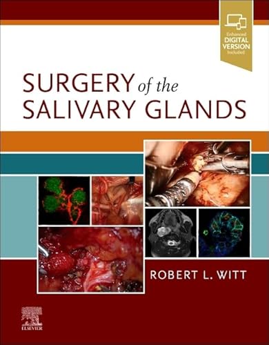 Read Surgery of the Salivary Glands, written by Robert L. Witt MD Read Surgery of the Salivary Glands, written by Robert L. Witt MD