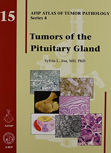 Read Tumors of the Pituitary Gland (Atlas of Tumor Pathology (Afip) 4th) (Atlas of Tumor Pathology (AFIP) 3rd Series), written by Sylvia L. Asa Read Tumors of the Pituitary Gland (Atlas of Tumor Pathology (Afip) 4th) (Atlas of Tumor Pathology (AFIP) 3rd Series), written by Sylvia L. Asa