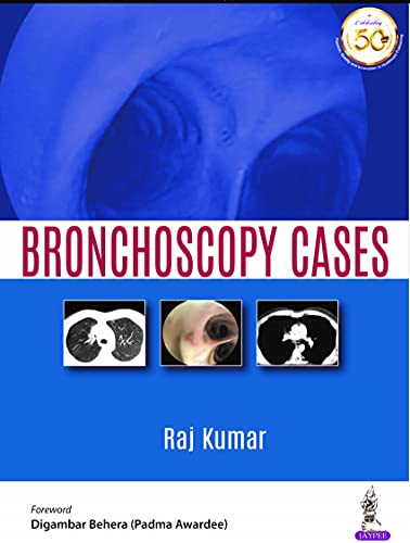 Read BRONCHOSCOPY CASES, written by Raj Kumar