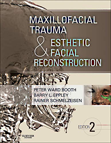Read Maxillofacial Trauma and Esthetic Facial Reconstruction, written by Peter Ward Booth BDS  MBChB  FDS  FRCS; Barry Eppley MD  DMD; Rainer Schmelzeisen MD  DDS  PhD