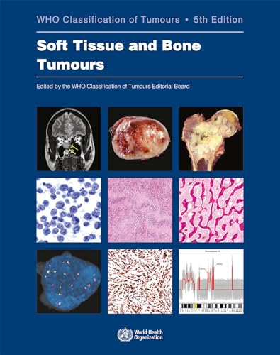 Read Soft Tissue and Bone Tumours: WHO Classification of Tumours (Medicine), written by WHO Classification of Tumours Editorial Board